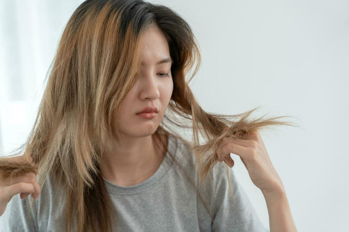 neu qua 35 ngay ke tu ky kinh nguyet gan nhat ma chi em van chua co kinh nguyet tro lai duoc coi la cham kinh. - Hình 1